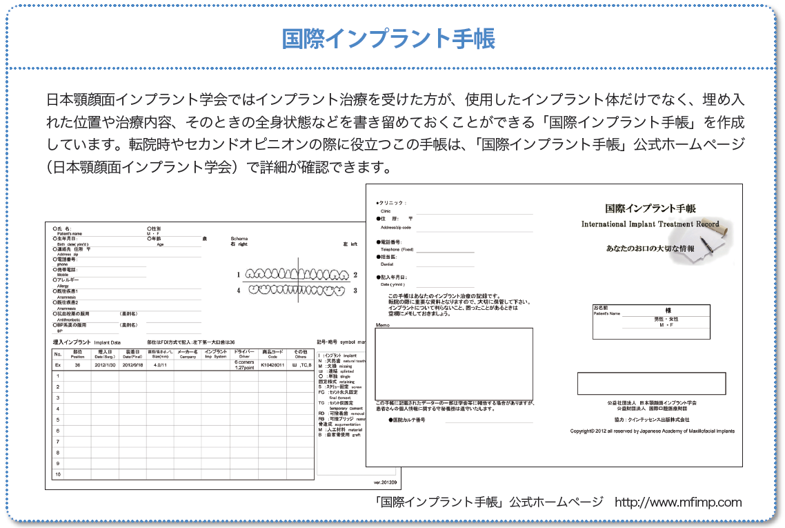 インプラント ストア 手帳