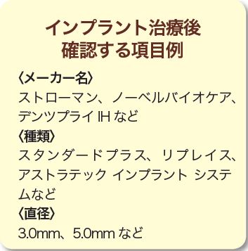 どのインプラントを使うか 知っておきましょう!