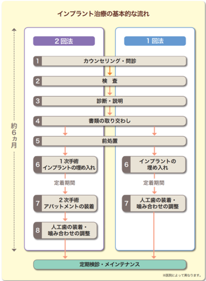 インプラント治療の流れを全体をとおして見てみましょう。