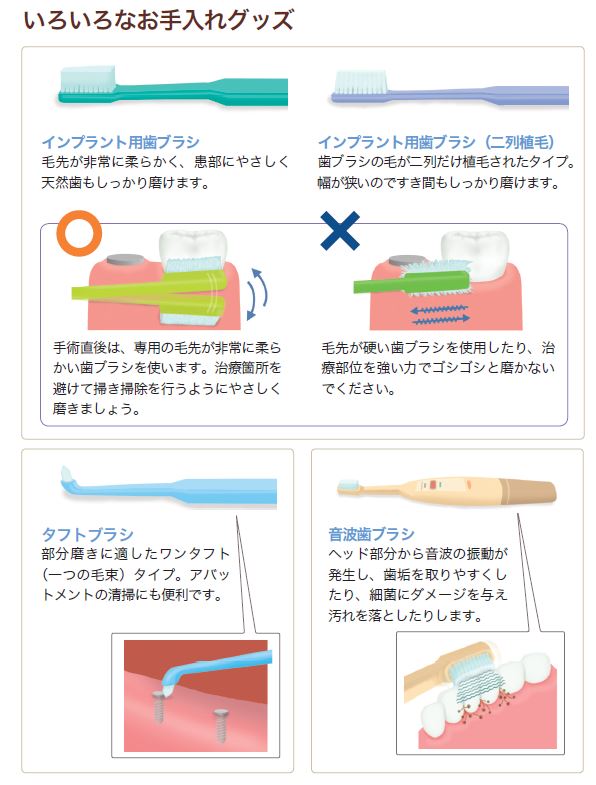 治療後のお手入れグッズとその正しい使い方