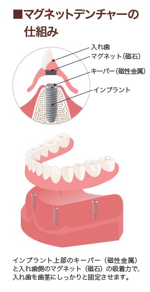 患者さんの症状に合わせたさまざまな治療法 その4