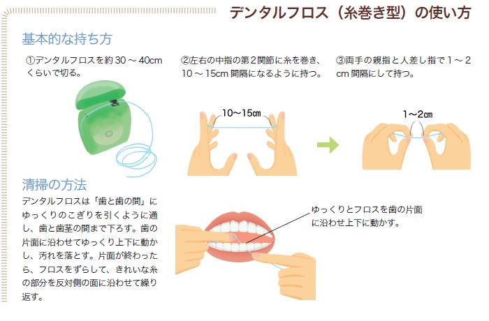 正しい毎日のお手入れで インプラントを守りましょう