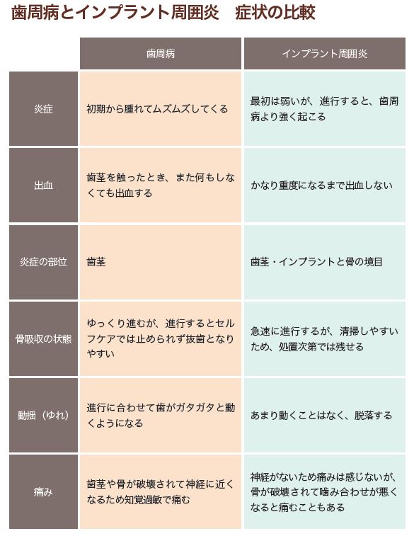 「インプラント周囲炎」の 症状と検査・治療法