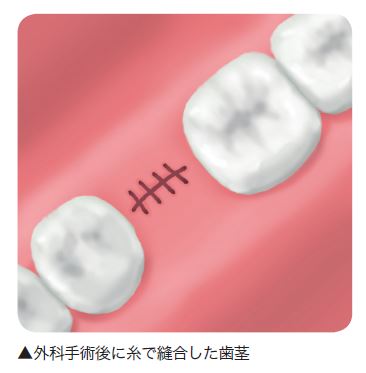 治療後の正しいお手入れを解説