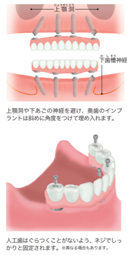 患者さんの症状に合わせたさまざまな治療法 その1