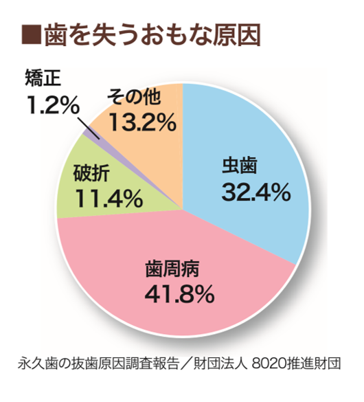 歯を失う原因を探ってみましょう