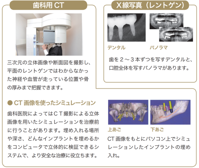 より安全なインプラント治療のために、術前検査はお口の中から全身まで。