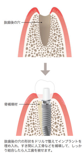 患者さんの症状に合わせたさまざまな治療法②