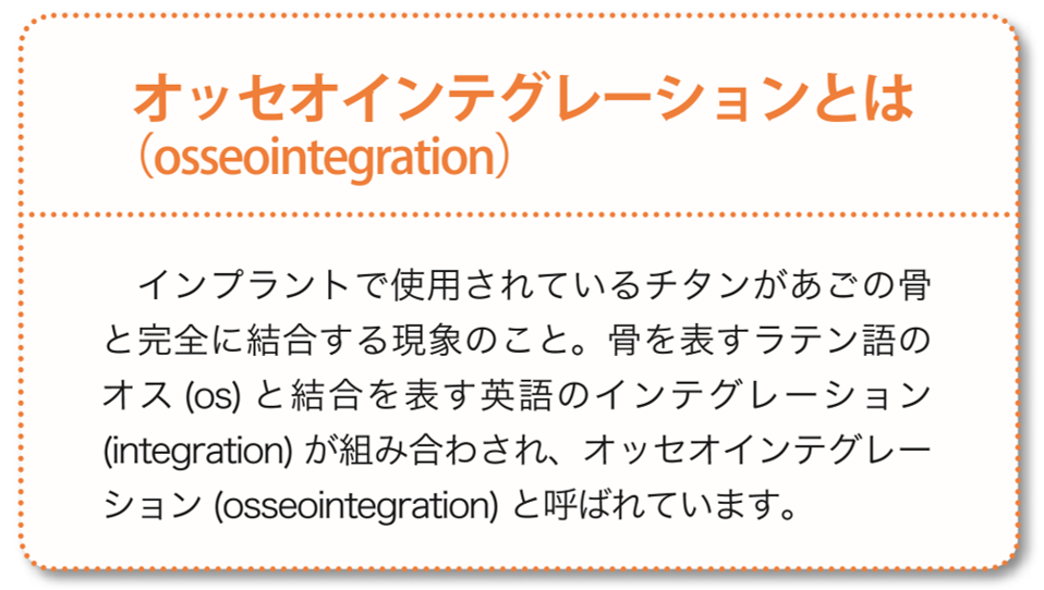 インプラント治療のはじまりと現在